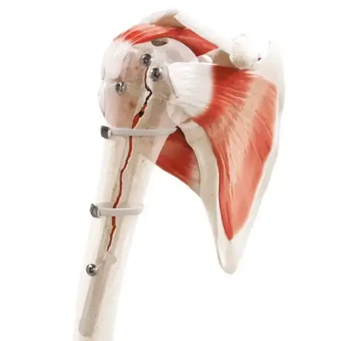 Strapflex